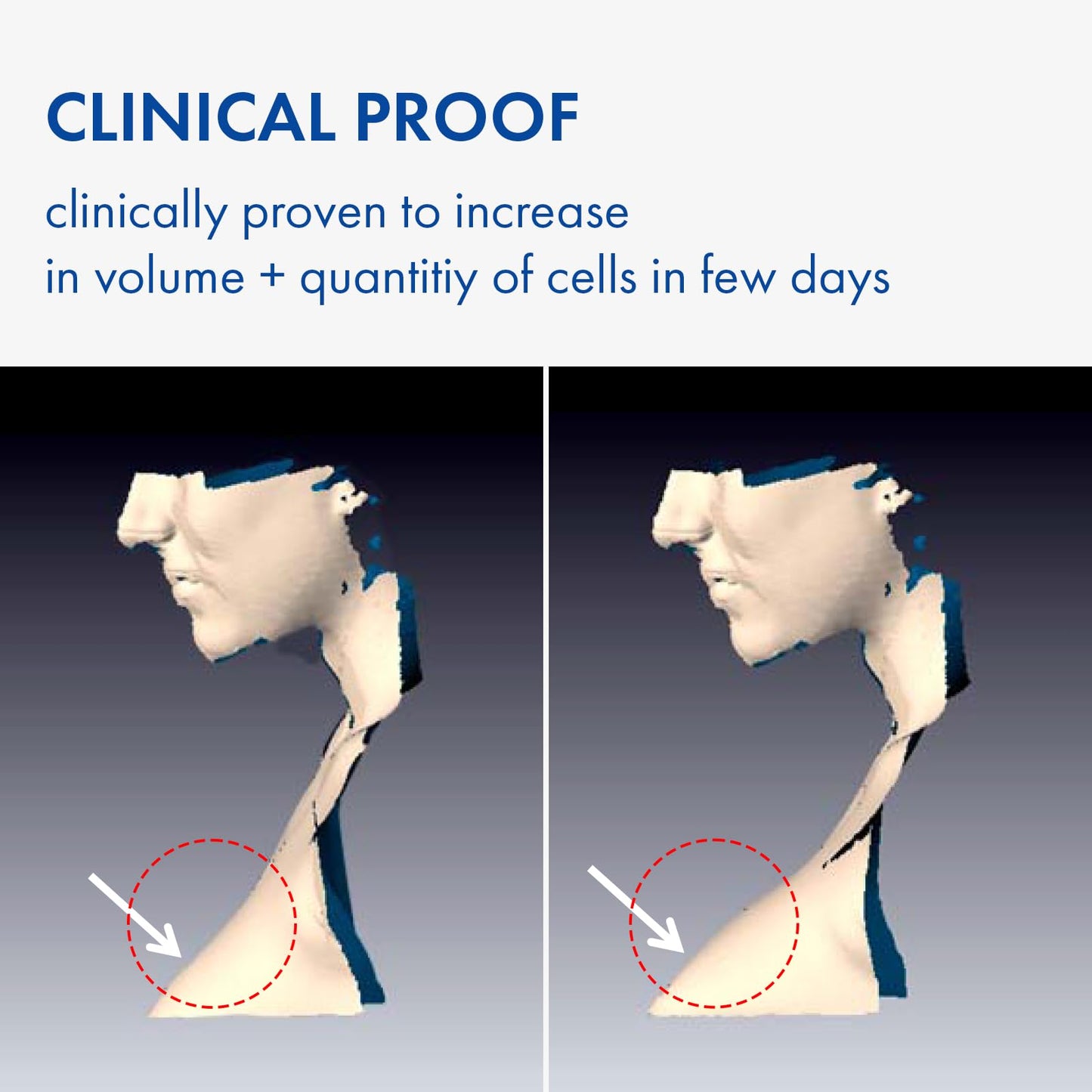 TOSOWOONG SOS Volufiline Serum, 100% France Sederma Volufiline, Glass skin, glow Skincare for Face, lip and body, 11ml 0.37 fl. oz.