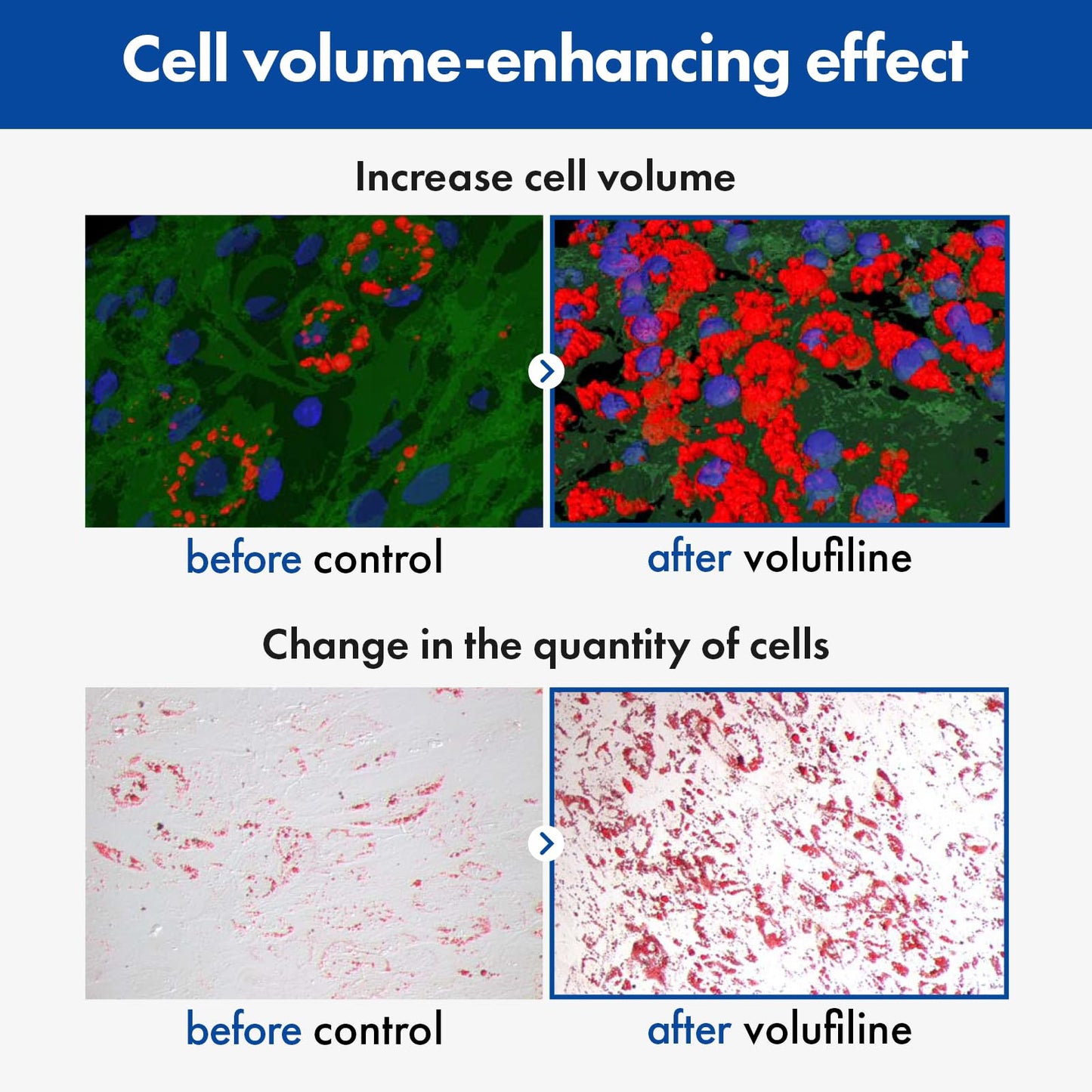 TOSOWOONG SOS Volufiline Serum, 100% France Sederma Volufiline, Glass skin, glow Skincare for Face, lip and body, 11ml 0.37 fl. oz.